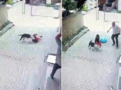 Pitbull, sokakta oynayan çocuğa saldırdı