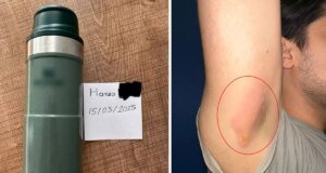 Dünyaca ünlü markanın termosu, genç adamı hastanelik etti