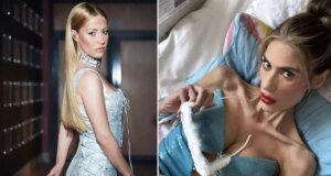 Nihal Candan’ın ardından İrem Derici ve Derya Uluğ’dan sarsansıcı Anoreksiya itirafı