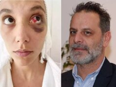 Ozan Güven’e ‘kasten yaralama’ suçundan hapis cezası