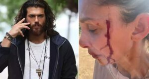 Can Yaman’ın sevgilisi Sara Bluma şiddet gördüğünü açıkladı