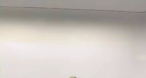 Şişlik yüzünden gitti, karnından çıkan doktorları bile şoke etti